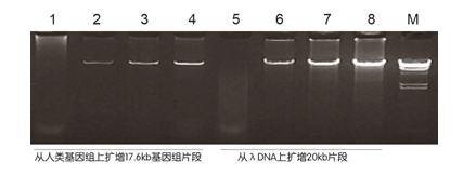 高保真聚合酶以人类基因组DNA为模板扩增