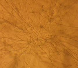 倒置显微镜下的霉菌形态，呈现树枝状
